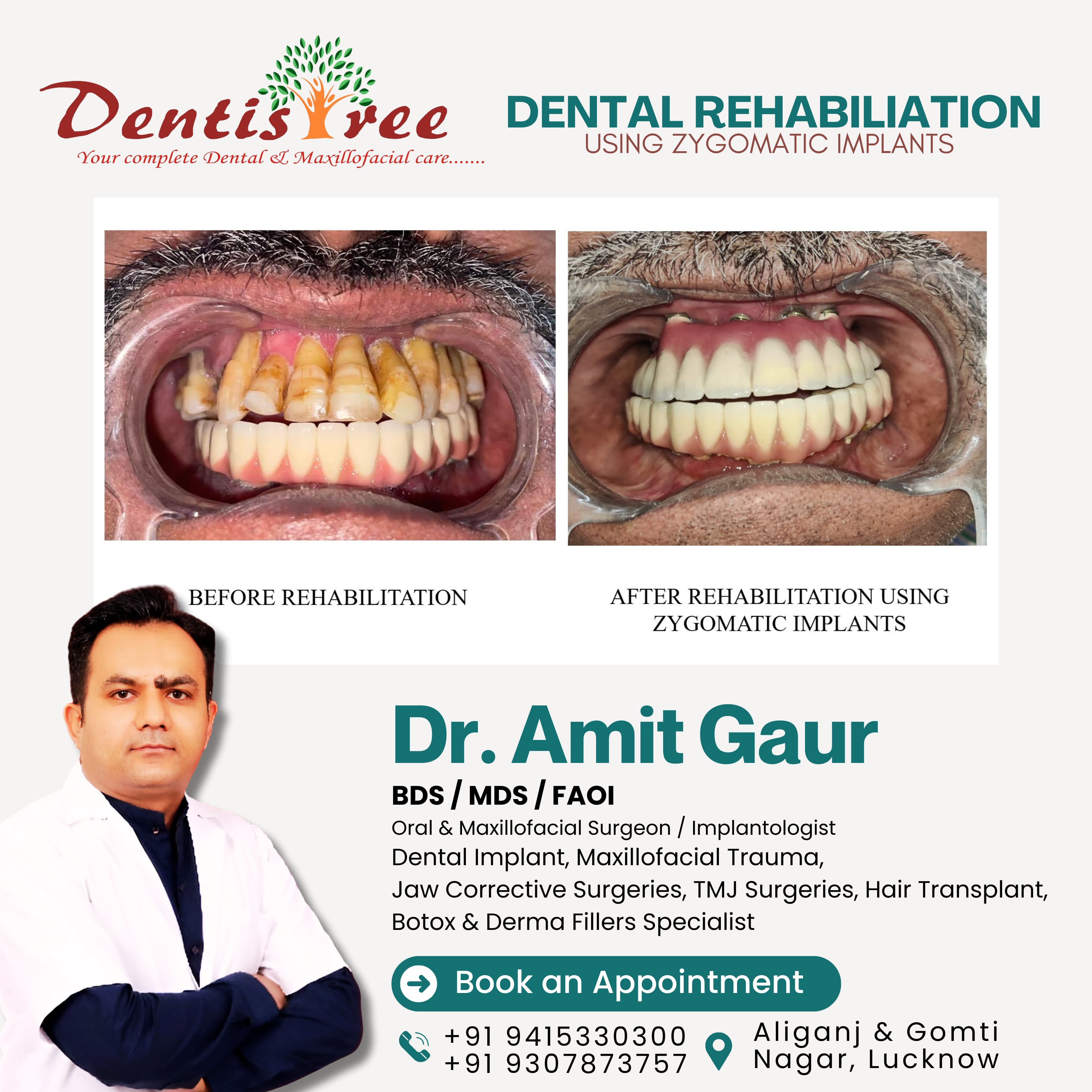 Maxillofacial Surgery